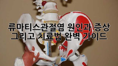 류마티스관절염, 원인과 증상, 그리고 치료법 완벽 가이드